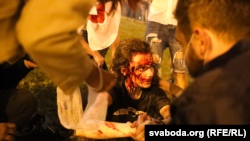 Кров, світлошумові гранати і сльозогінний газ. У Білорусі силовики жорстоко розігнали протестувальників після виборів (фоторепортаж)